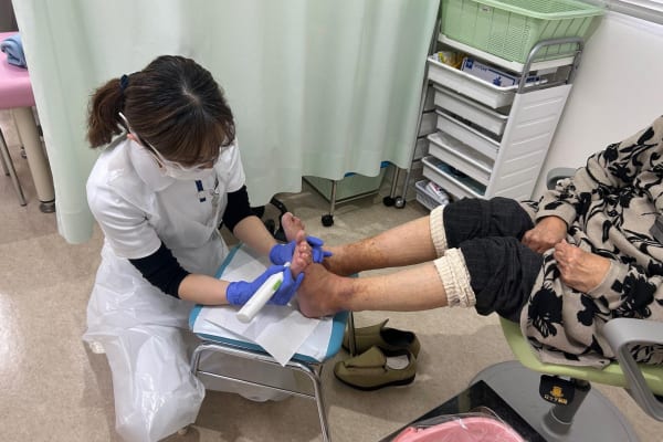 専門看護師によるフットケア